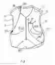 Fig. 02 - Blo-warm vest