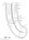 Fig. 20 - Devices for cleaning endotracheal tubes