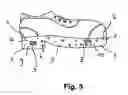 Fig. 03 - SHOE FOR MEDICAL APPLICATIONS