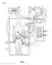 Fig. 02 - Sterile surgical drape
