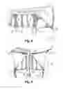 Fig. 06 - BLIND WITH STRUCTURE FOR RAPID SETUP