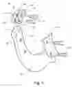 Fig. 06 - Log debarking tool and tool tip