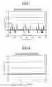 Fig. 06 - METHOD AND APPARATUS FOR DETERMINING SUBSTRATE CONCENTRATION AND REAGENT FOR DETERMINING SUBSTRATE CONCENTRATION
