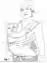 Fig. 02 - Baby carrier