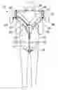 Fig. 01 - Personal propulsion device