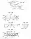 Fig. 14 - Arm apparatus with reinforcement