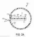 Fig. 04 - Baffled treatball