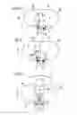 Fig. 05 - Airbag module