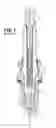 Fig. 02 - Spark plug having a plastic upper insulator and method of construction
