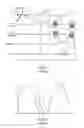 Fig. 04 - SYSTEM AND METHOD FOR PASSIVE CATHETER TRACKING WITH MAGNETIC RESONANCE IMAGING