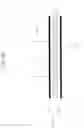 Fig. 06 - Flat uniform transmission line having electromagnetic shielding function