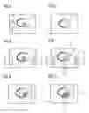 Fig. 03 - Method and device selective presentation of two images individually or combined as a fusion image