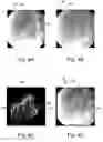 Fig. 05 - METHOD AND APPARATUS FOR RECONSTRUCTING AN IMAGE
