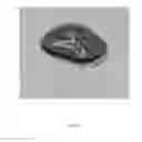 Fig. 09 - ANATOMICALLY REALISTIC THREE DIMENSIONAL PHANTOMS FOR MEDICAL IMAGING