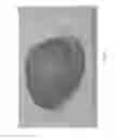 Fig. 10 - ANATOMICALLY REALISTIC THREE DIMENSIONAL PHANTOMS FOR MEDICAL IMAGING
