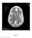 Fig. 11 - ANATOMICALLY REALISTIC THREE DIMENSIONAL PHANTOMS FOR MEDICAL IMAGING