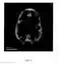 Fig. 12 - ANATOMICALLY REALISTIC THREE DIMENSIONAL PHANTOMS FOR MEDICAL IMAGING