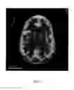 Fig. 13 - ANATOMICALLY REALISTIC THREE DIMENSIONAL PHANTOMS FOR MEDICAL IMAGING