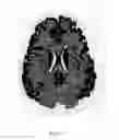 Fig. 14 - ANATOMICALLY REALISTIC THREE DIMENSIONAL PHANTOMS FOR MEDICAL IMAGING