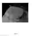 Fig. 16 - ANATOMICALLY REALISTIC THREE DIMENSIONAL PHANTOMS FOR MEDICAL IMAGING