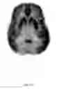 Fig. 17 - ANATOMICALLY REALISTIC THREE DIMENSIONAL PHANTOMS FOR MEDICAL IMAGING