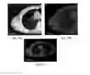 Fig. 20 - ANATOMICALLY REALISTIC THREE DIMENSIONAL PHANTOMS FOR MEDICAL IMAGING
