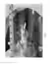 Fig. 23 - ANATOMICALLY REALISTIC THREE DIMENSIONAL PHANTOMS FOR MEDICAL IMAGING
