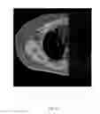 Fig. 25 - ANATOMICALLY REALISTIC THREE DIMENSIONAL PHANTOMS FOR MEDICAL IMAGING
