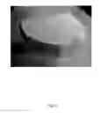 Fig. 27 - ANATOMICALLY REALISTIC THREE DIMENSIONAL PHANTOMS FOR MEDICAL IMAGING
