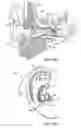Fig. 07 - Hearing system having improved high frequency response