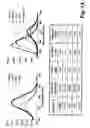 Fig. 02 - Annulus fibrosus detection in intervertebral discs using molecular imaging agents