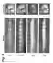 Fig. 06 - Annulus fibrosus detection in intervertebral discs using molecular imaging agents