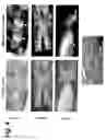 Fig. 07 - Annulus fibrosus detection in intervertebral discs using molecular imaging agents