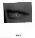 Fig. 03 - Goniochromatic/light reflective cosmetic makeup compositions