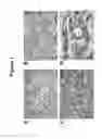 Fig. 02 - B7-H3 IN CANCER