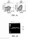 Fig. 06 - METHOD AND COMPOSITION FOR TREATING IMMUNE COMPLEX ASSOCIATED DISORDERS