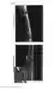 Fig. 04 - Resin complex containing carbon nanotube and method for production thereof