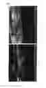 Fig. 07 - Resin complex containing carbon nanotube and method for production thereof
