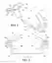 Fig. 02 - Illuminated dental retractor