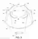 Fig. 03 - Illuminated dental retractor