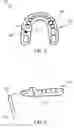 Fig. 02 - DENTAL IMPLANT SYSTEM AND METHODS