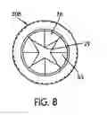 Fig. 07 - Method for accessing the contents of a closed vessel containing a specimen retrieval device
