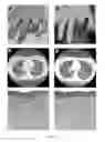 Fig. 02 - Profiling for Determination of Response to Treatment for Inflammatory Disease