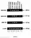 Fig. 22 - Method of treating glaucoma comprising administering a composition comprising human BMP7