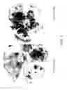 Fig. 02 - USE OF HEAT SHOCK ACTIVATORS FOR TISSUE REGENERATION