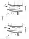 Fig. 08 - Pulsatile blood pump