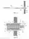 Fig. 08 - Expandable port for accessing a bodily opening