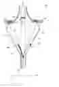 Fig. 01 - IMAGING CATHETERS HAVING IRRIGATION