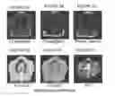 Fig. 08 - System and method for correcting attenuation in hybrid medical imaging