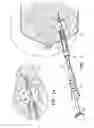 Fig. 02 - ANCHOR MARKERS